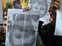 Studentenprotest gegen Ahmadinedschad; Foto: AP