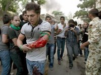 معرض إيراني ضحية قمع النظام الإيراني، الصورة: د.ب.