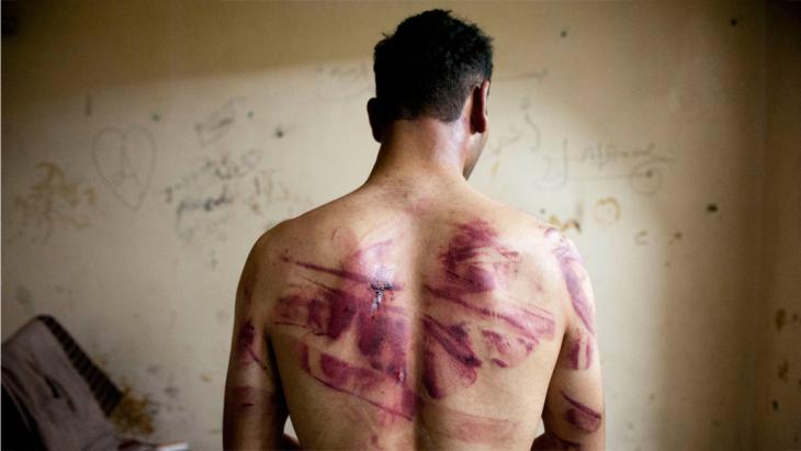 Torture victim from Aleppo (photo: Getty Images/AFP/J. Lawler)