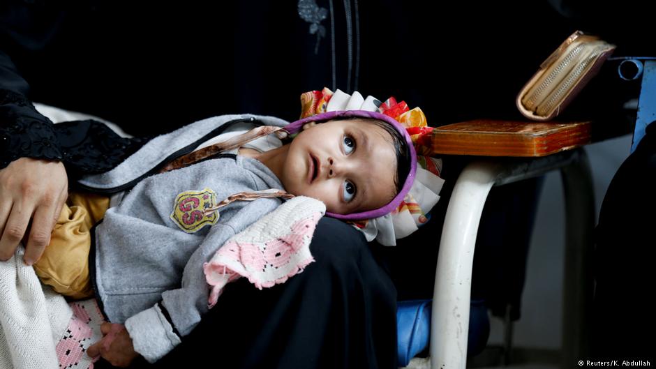 Kind im  im Krebszentrum in Sanaa; Foto: Reuters/K. Abdullah