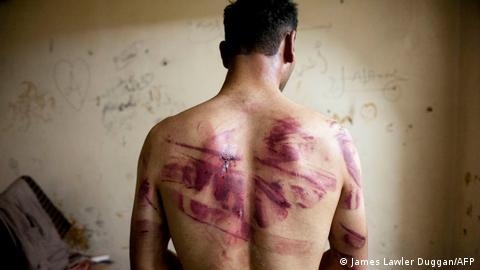 صورة رمزية تعذيب النظام السوري وإذلاله للناس في سوريا. Symbolbild Unterdrückung in Syrien Foto AFP