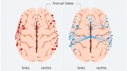 Sichtbar gemacht: die verschiedenen Sprachnetzwerke im Gehirn. 