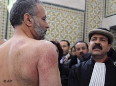 Verletzter tunesischer Anwalt Abdraouf Ayadi; Foto: AP