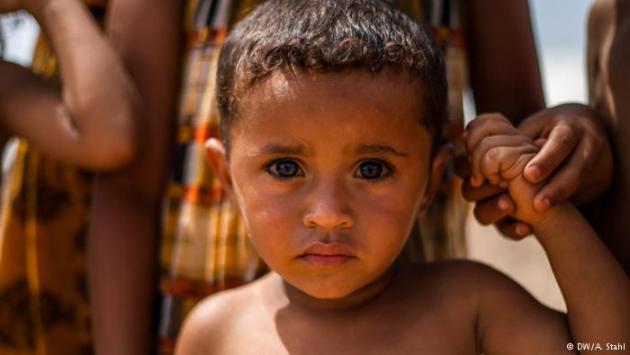 A Yemeni child, Markazi refugee camp, Djibouti (photo: DW/Andreas Stahl)