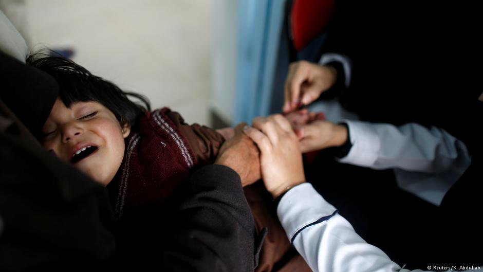 Medizinische Behandlung eines an Cholera erkrankten Kindes in Sanaa, Jemen; Foto: Reuters