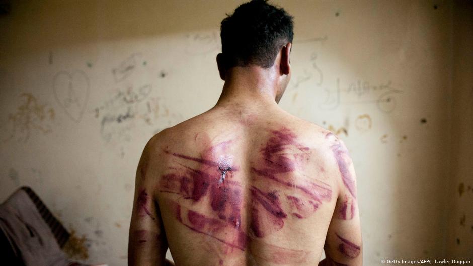 Syrian torture victim (photo: Getty Images/AFP/J. Lawler Duggan)