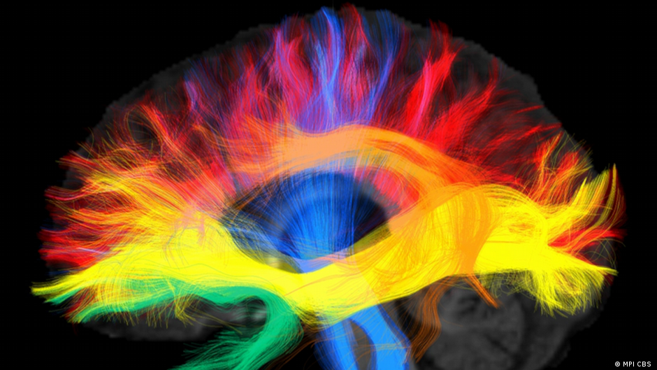توضيح مرئي للشبكات اللغوية المختلفة في الدماغ Forschung Bunt dargestellte Sprachnetzwerke im Gehirn Bild MPI CBS - Sichtbar gemacht: die verschiedenen Sprachnetzwerke im Gehirn