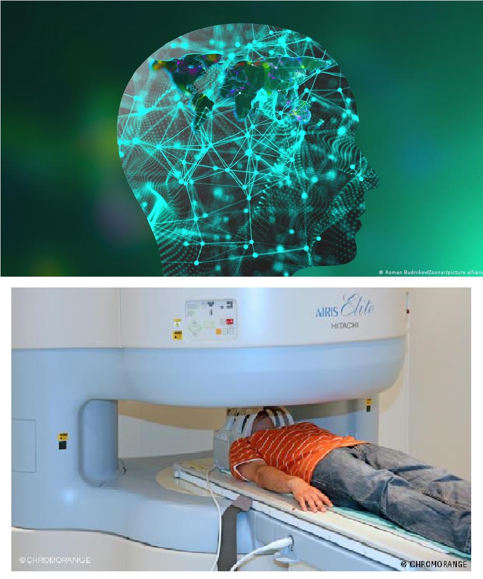 يتيح المسح بجهاز التصوير بالرنين المغناطيسي (MRI) صوراً عالية الدقة للدماغ. MRT Hirn Foto Picture Alliance und Chromorange